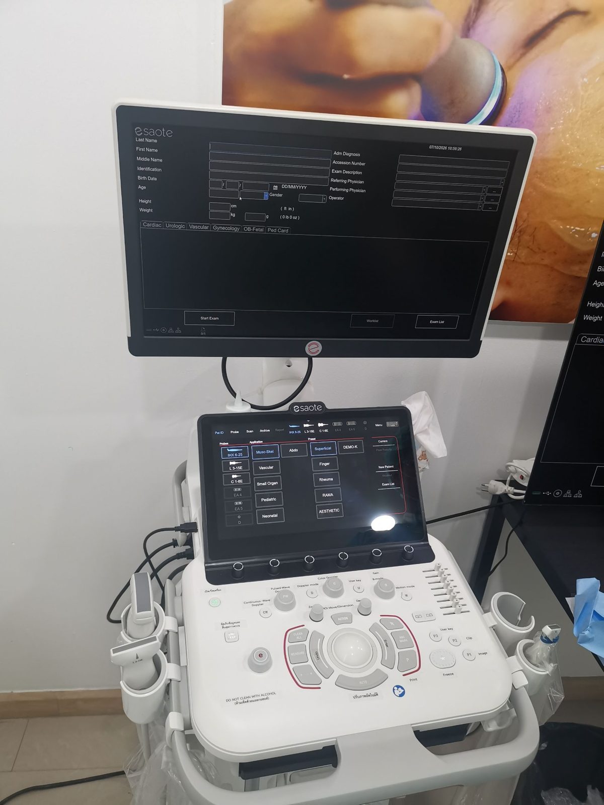 주사 전 초음파로 혈관 위치를 확인해 올바른 층에 필러 배치